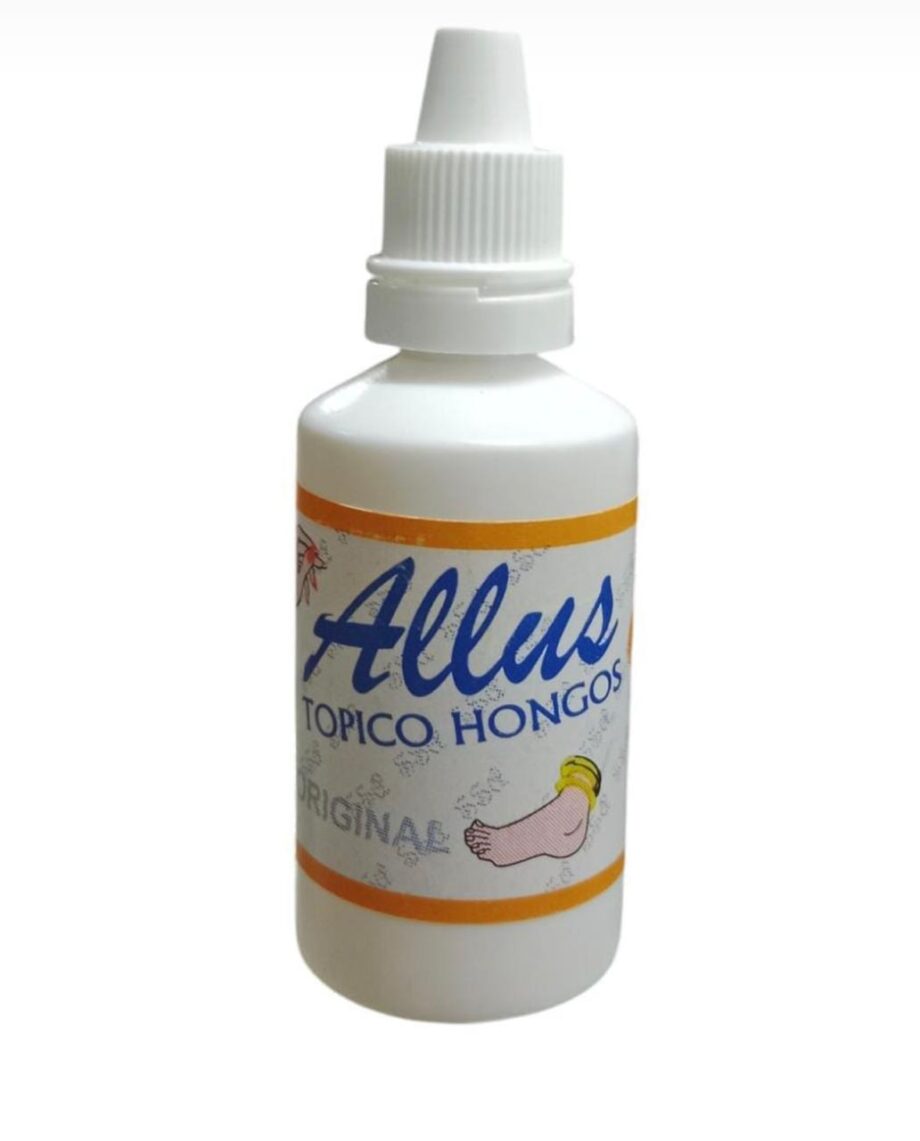 ALLUS